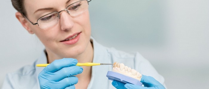Zahnkrone – das Oberste an Ihren Zähnen